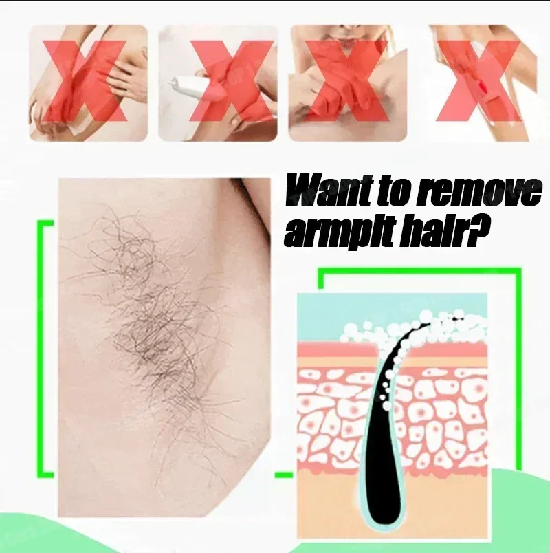Hair Removal Spray Powerful Ha - Hair Care Korean Products recension och pris